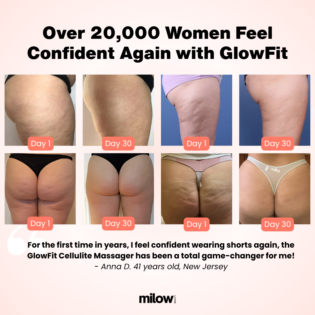 Masajeador de celulitis GlowFit™ 2.0
